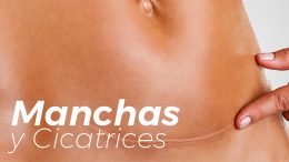 Manchas Y Cicatrices