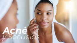 Acné Y Secuelas